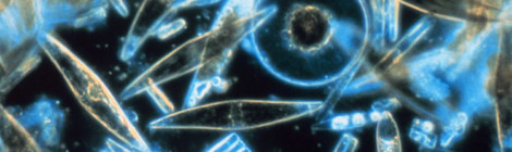 Assorted diatoms as seen through a microscope.