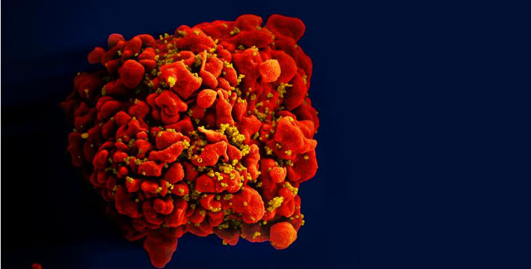 Effects of brief messaging about undiagnosed infections detected through HIV testing