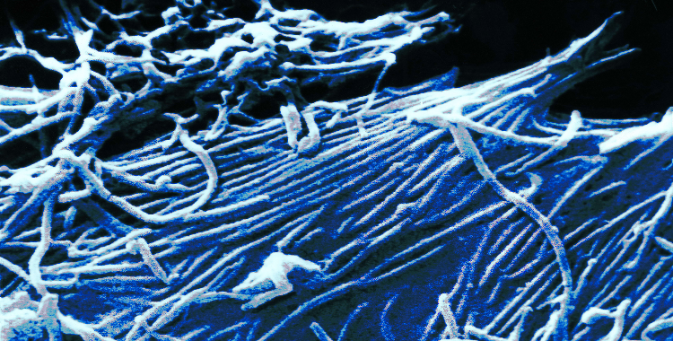 The potential for sexual transmission to compromise control of Ebola virus outbreaks