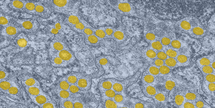 Waiting time to infectious disease emergence